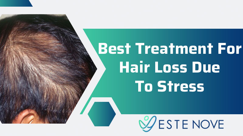Best Treatment For Hair Loss Due To Stress