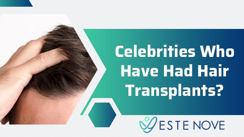Celebrities Who Have Had Hair Transplants