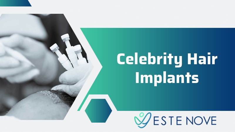 Celebrity Hair Implants