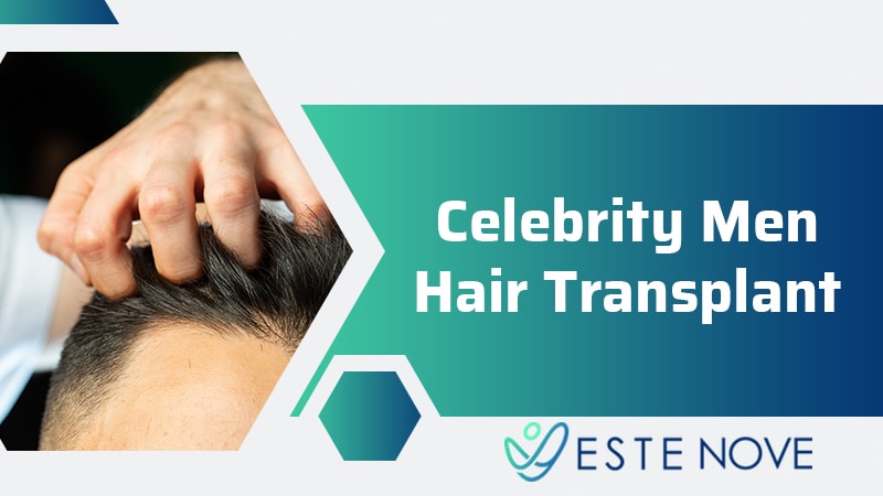 Celebrity Men Hair Transplant