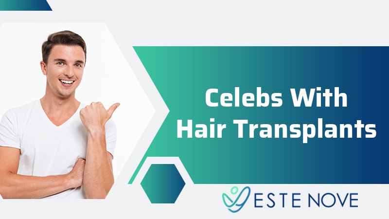 Celebs With Hair Transplants