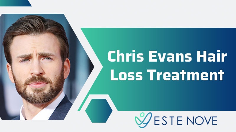 Chris Evans Hair Loss Treatment - Estenove