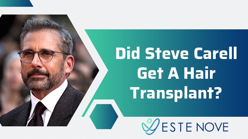 Did Steve Carell Get A Hair Transplant?