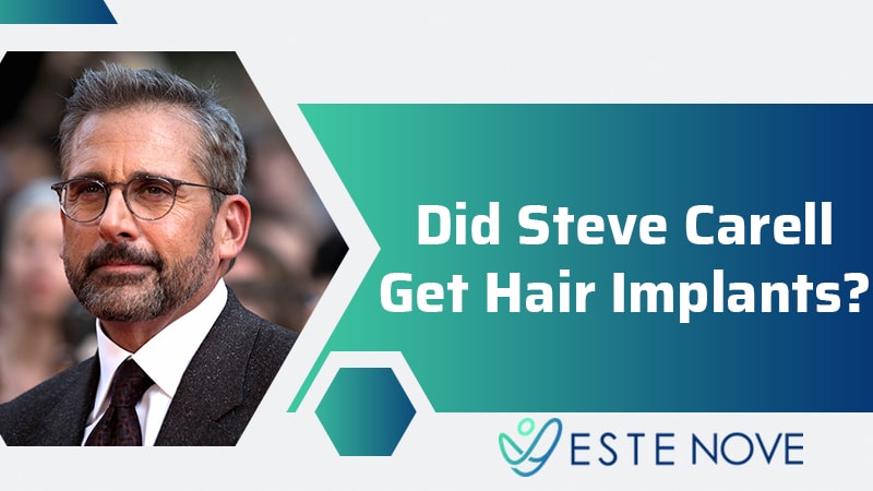 Did Steve Carell Get Hair Implants?