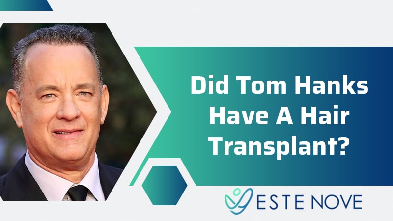 Did Tom Hanks Have a Hair Transplant?