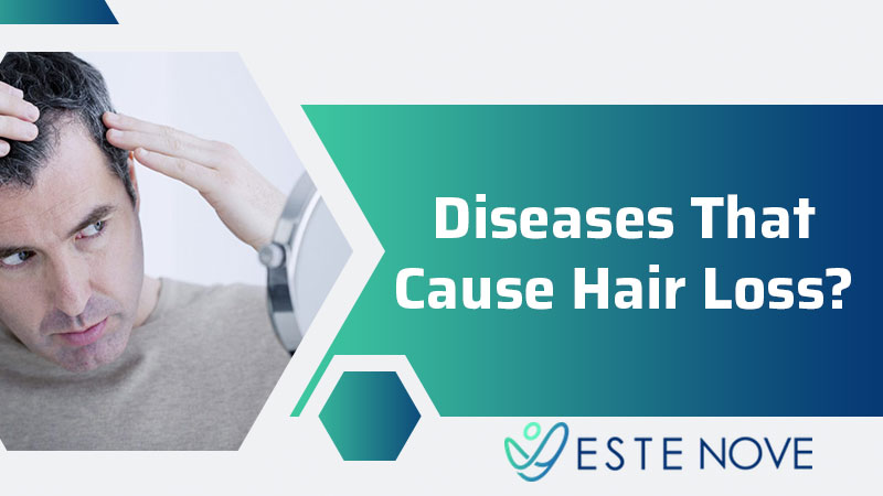 Diseases That Cause Hair Loss