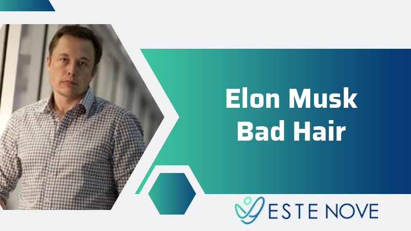 Elon Musk Bad Hair