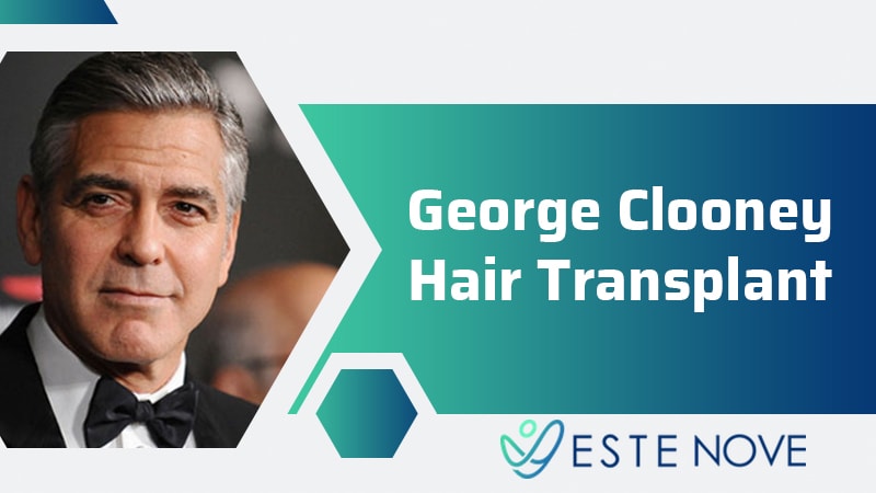 George Clooney Hair Transplant