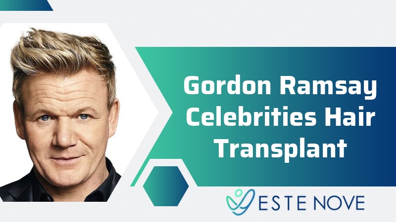 Gordon Ramsay Celebrities Hair Transplant