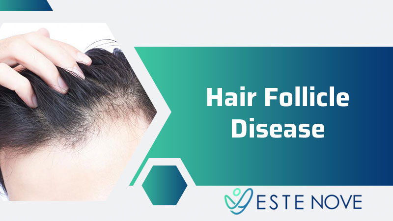 Hair Follicle Disease