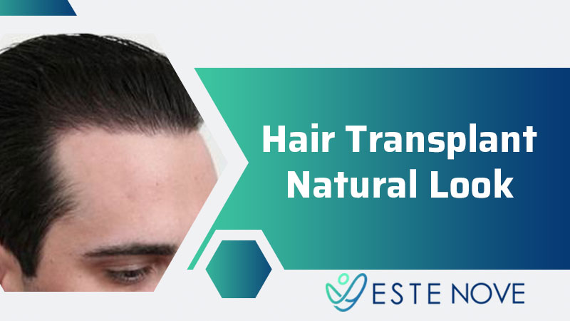 Hair Transplant Natural Look