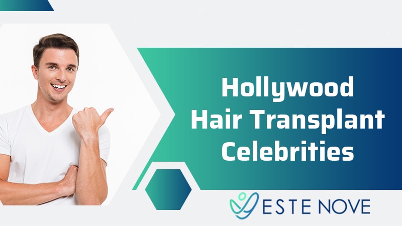 Hollywood Hair Transplant Celebrities