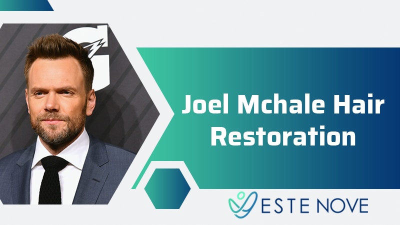 Joel Mchale Hair Restoration