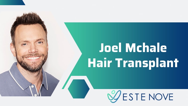 Joel Mchale Hair Transplant
