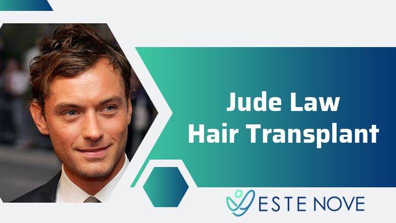 Jude Law Hair Transplantation