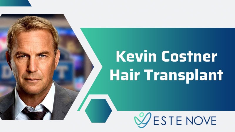 Kevin Costner Hair Transplant