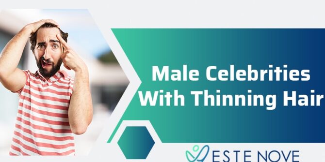 Male Celebrities With Thinning Hair