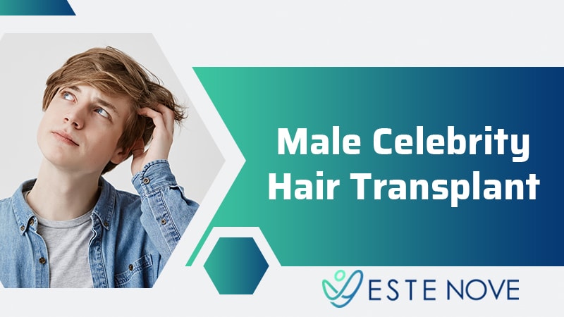Male Celebrity Hair Transplant