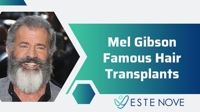 Mel Gibson Famous Hair Transplant