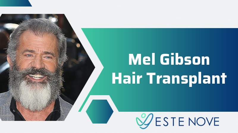 Mel Gibson Hair Transplant