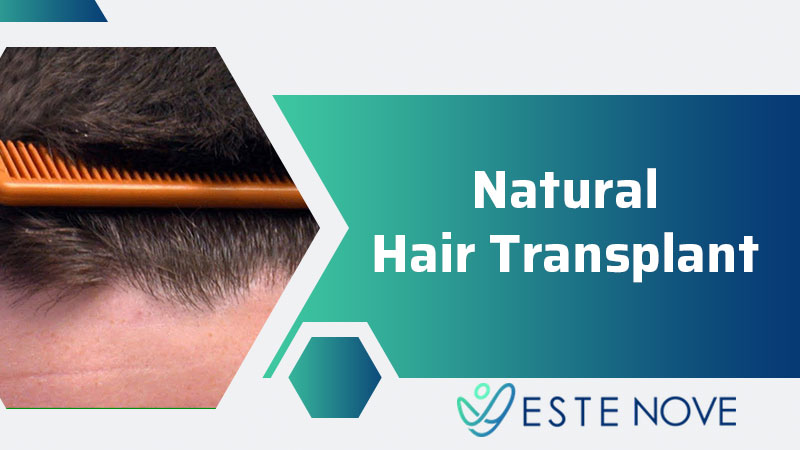 Natural Hair Transplant