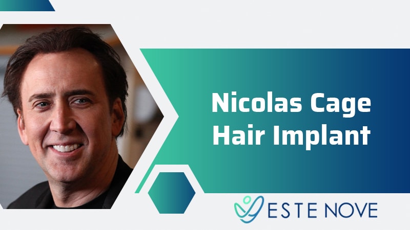 Nicolas Cage Hair Implant