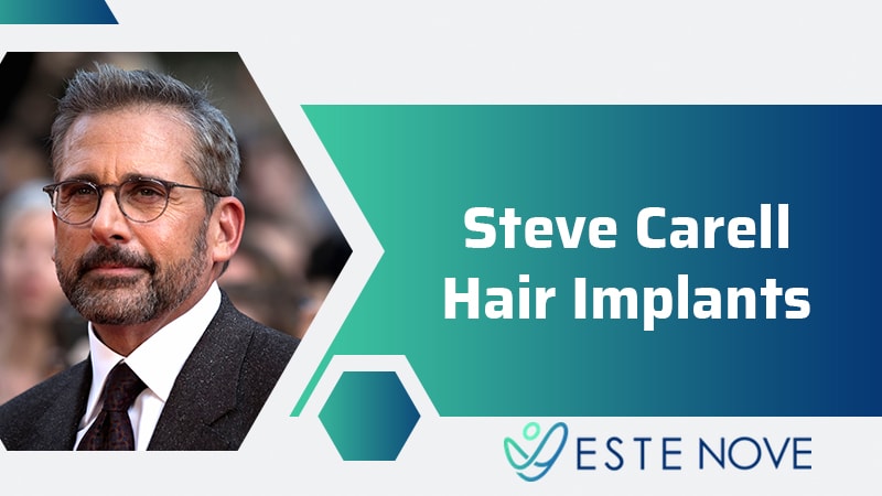 Steve Carell Hair Implants