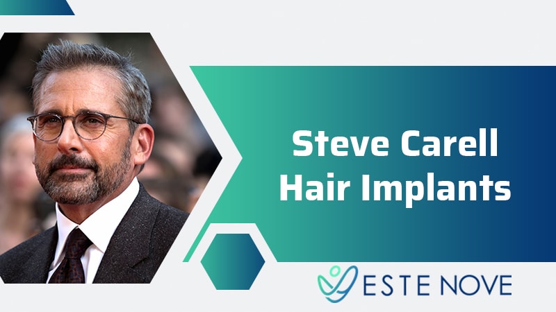 Steve Carell Hair Implants
