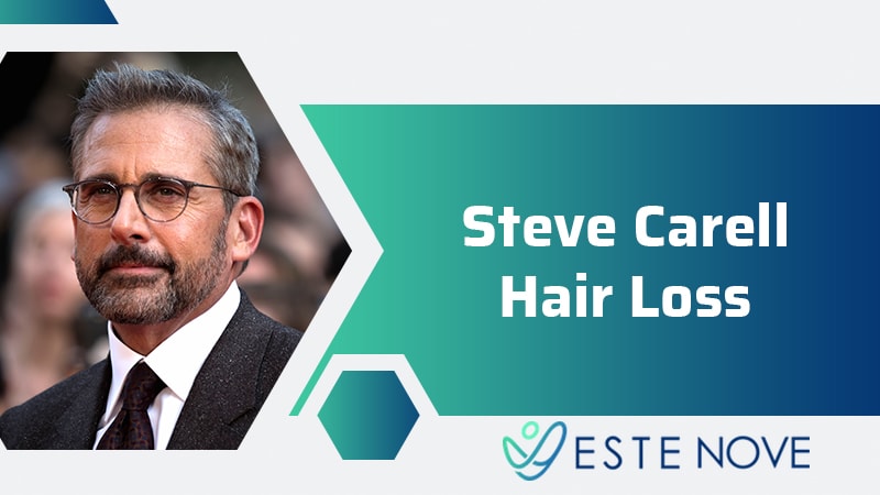 Steve Carell Hair Loss
