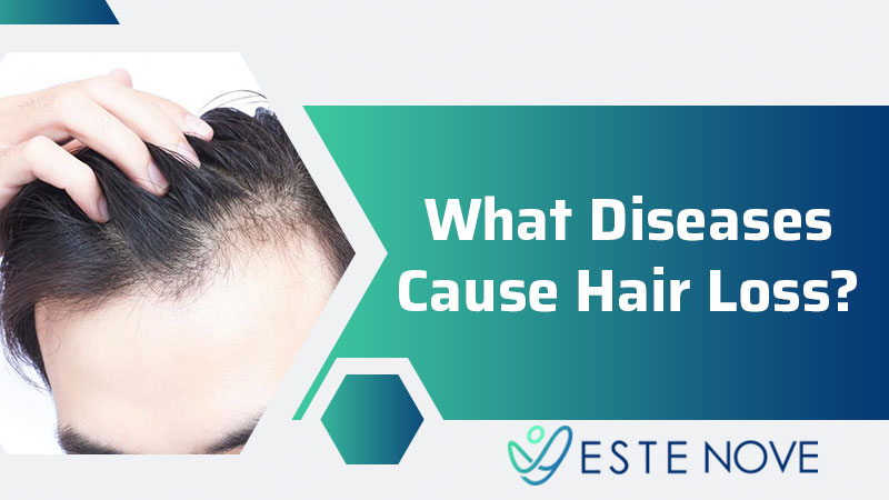 What Diseases Cause Hair Loss?