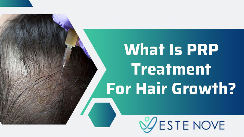 What Is PRP Hair Treatment?