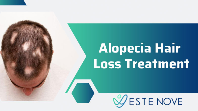 Alopecia Hair Loss Treatment