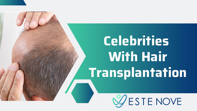Celebrities With Hair Transplantation