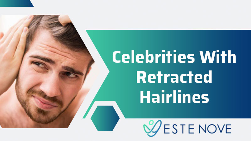 Celebrities With Retracted Hairlines