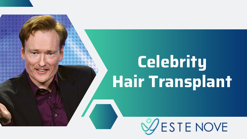 Celebrity Hair Transplant