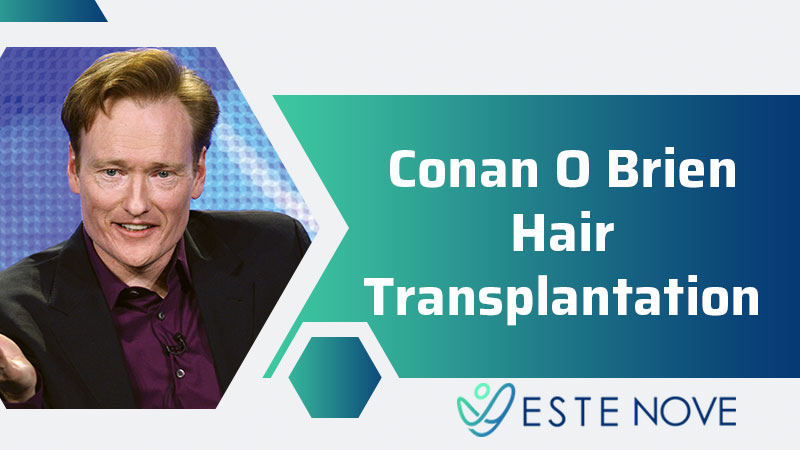 Conan O Brien Hair Transplantation