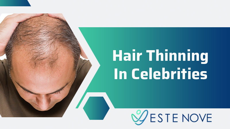Hair Thinning In Celebrities