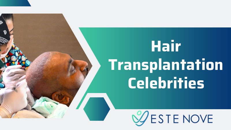 Hair Transplantation Celebrities
