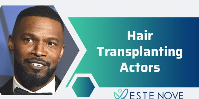 Hair Transplanting Actors