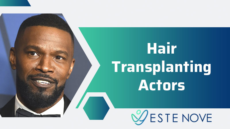 Hair Transplanting Actors