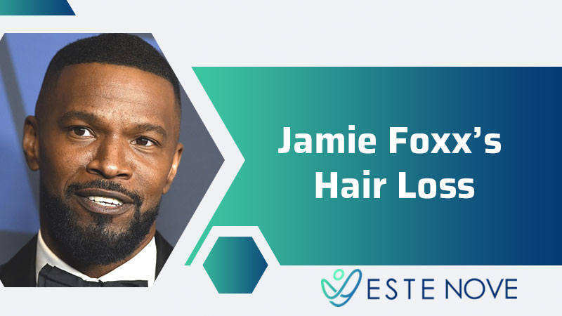 Jamie Foxx’s Hair Loss