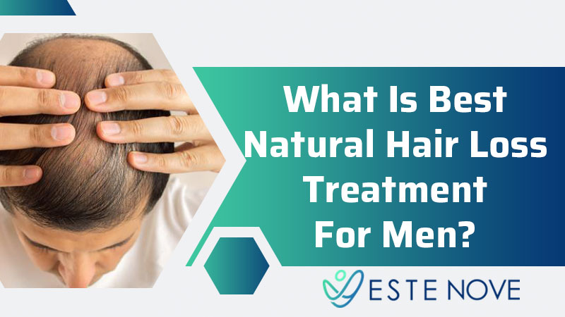 What Is Best Natural Hair Loss Treatment For Men?