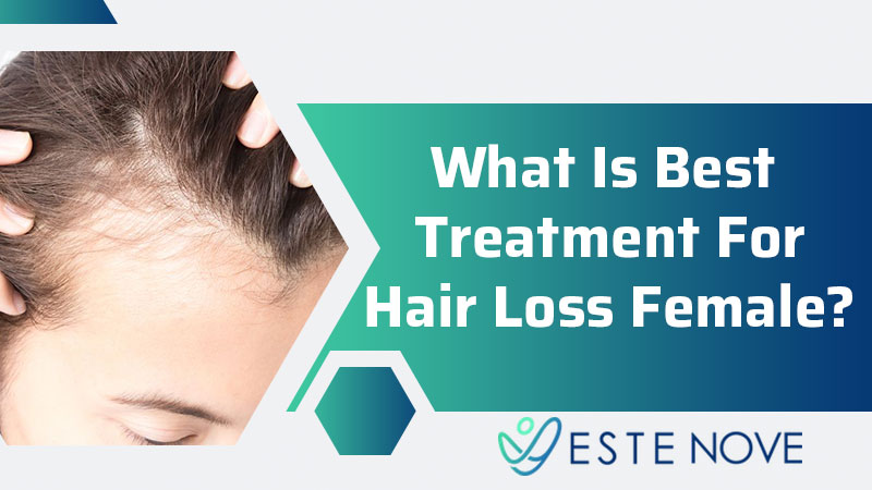 What Is Best Treatment For Hair Loss Female?
