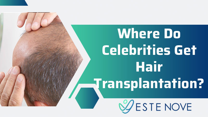 Where Do Celebrities Get Hair Transplantation? - EsteNove