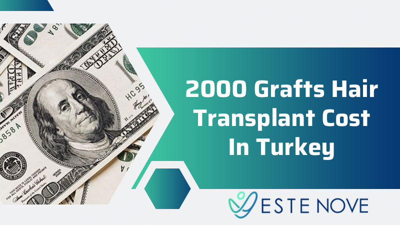2000 Grafts Hair Transplant Cost In Turkey