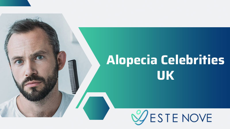 Alopecia Celebrities UK