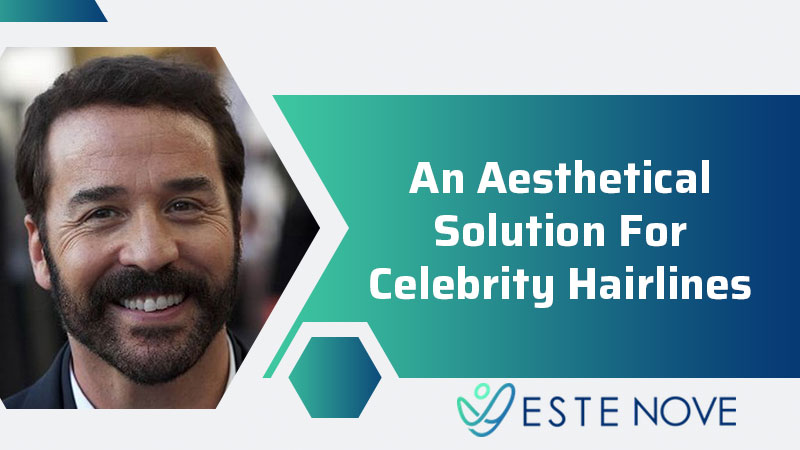 An Aesthetical Solution For Celebrity Hairlines