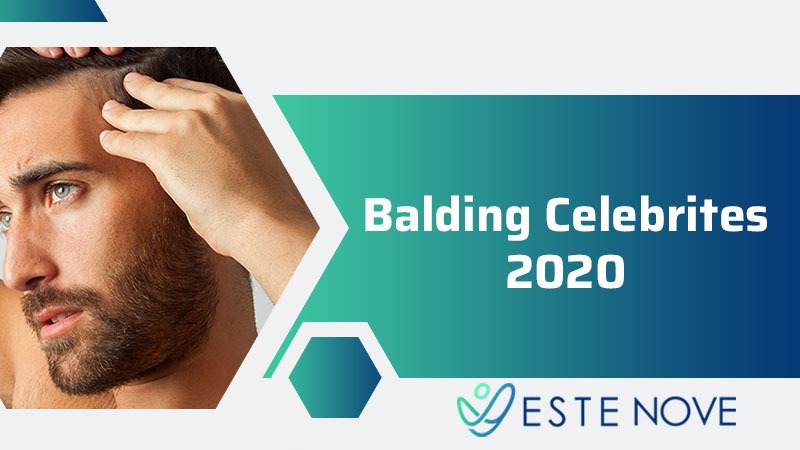 Balding Celebrities 2020
