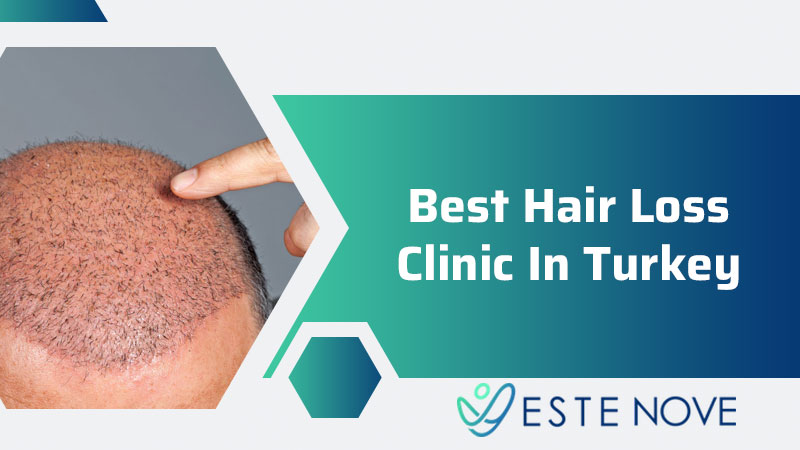 Best Hair Loss Clinic in Turkey