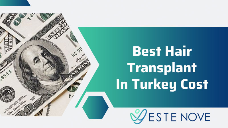 Best Hair Transplant In Turkey Cost